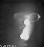 [PICTURE-head photogram]